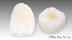 ホワイトジルコニアクラウン