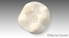 ホワイトe.セラミック