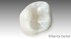 ジルコレックス