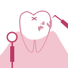 歯周病の改善